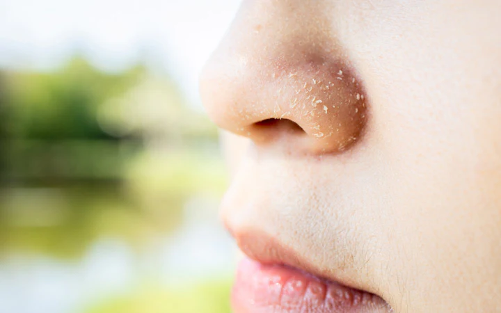 7 Trivial Habits That Can Cause a Dry Nose